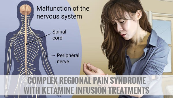Complex Regional Pain Syndrome (CRPS) Treatment