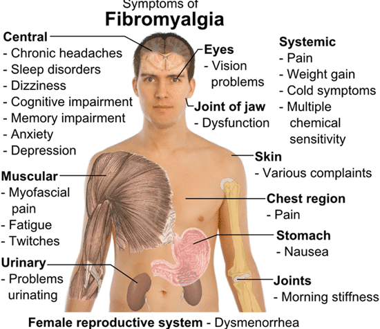 IV Ketamine Infusion Therapy to Help Manage the Pain of Fibromyalgia